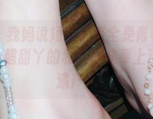微密圈 – 我妈说短裙瑕疵全是青春的印记，YuYu超甜丫的私拍图集奉上这道青春遗产！
